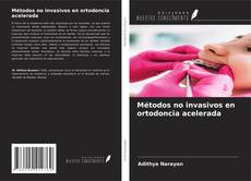 Copertina di Métodos no invasivos en ortodoncia acelerada