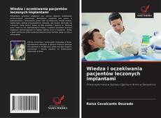 Wiedza i oczekiwania pacjentów leczonych implantami kitap kapağı