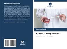 Bookcover of Leberbiopsiepunktion