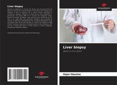 Borítókép a  Liver biopsy - hoz