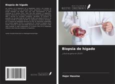 Copertina di Biopsia de hígado