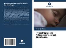 Couverture de Hypertrophische Pylorusstenose bei Säuglingen