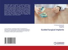 Copertina di Guided Surgical Implants
