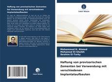 Capa do livro de Haftung von provisorischen Zementen bei Verwendung mit verschiedenen Implantataufbauten 