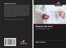 Biopsia del liver的封面