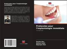 Copertina di Protocoles pour l'implantologie immédiate
