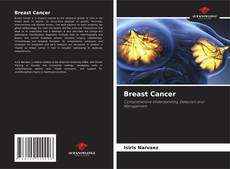 Borítókép a  Breast Cancer - hoz