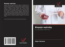Biopsja wątroby kitap kapağı