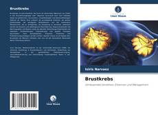 Portada del libro de Brustkrebs