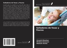 Selladores de fosas y fisuras kitap kapağı