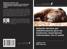 Ablación térmica por radiofrecuencia para los trastornos respiratorios relacionados con el sueño的封面