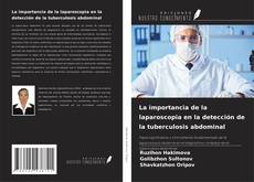 Buchcover von La importancia de la laparoscopia en la detección de la tuberculosis abdominal