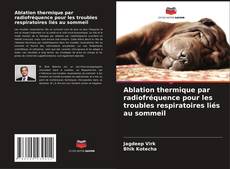 Buchcover von Ablation thermique par radiofréquence pour les troubles respiratoires liés au sommeil