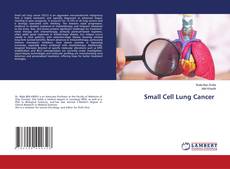 Copertina di Small Cell Lung Cancer