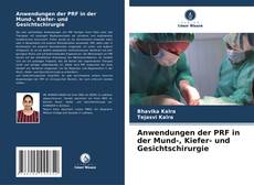 Обложка Anwendungen der PRF in der Mund-, Kiefer- und Gesichtschirurgie