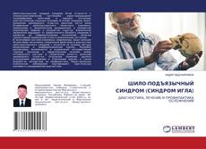 Capa do livro de ШИЛО-ПОДЪЯЗЫЧНЫЙ СИНДРОМ (СИНДРОМ ИГЛА) 