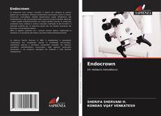 Bookcover of Endocrown