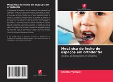 Bookcover of Mecânica do fecho de espaços em ortodontia