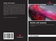 Sickle cell anemia的封面