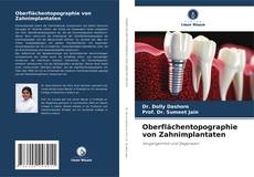 Portada del libro de Oberflächentopographie von Zahnimplantaten