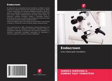 Copertina di Endocrown