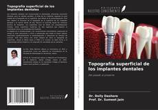 Topografía superficial de los implantes dentales的封面
