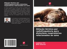 Bookcover of Ablação térmica por radiofrequência para distúrbios respiratórios relacionados ao sono