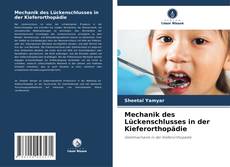 Mechanik des Lückenschlusses in der Kieferorthopädie的封面
