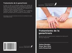 Borítókép a  Tratamiento de la gonartrosis - hoz