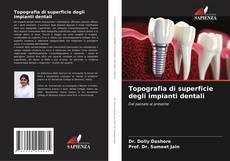 Couverture de Topografia di superficie degli impianti dentali