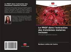 Copertina di Le PRGF dans l'extraction des troisièmes molaires incluses
