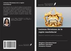 Couverture de Lesiones fibroóseas de la región maxilofacial