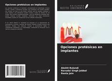 Copertina di Opciones protésicas en implantes