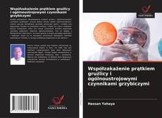 Buchcover von Współzakażenie prątkiem gruźlicy i ogólnoustrojowymi czynnikami grzybiczymi