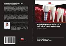 Topographie de surface des implants dentaires的封面