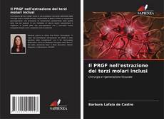 Couverture de Il PRGF nell'estrazione dei terzi molari inclusi