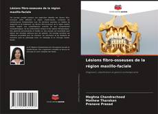 Copertina di Lésions fibro-osseuses de la région maxillo-faciale