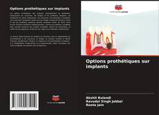 Bookcover of Options prothétiques sur implants