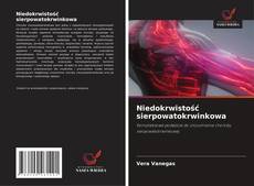 Couverture de Niedokrwistość sierpowatokrwinkowa