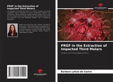 Bookcover of PRGF in the Extraction of Impacted Third Molars