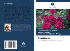 Couverture de Brustkrebs