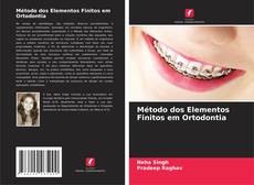 Bookcover of Método dos Elementos Finitos em Ortodontia
