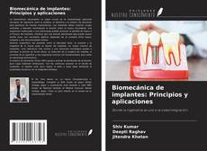 Copertina di Biomecánica de implantes: Principios y aplicaciones