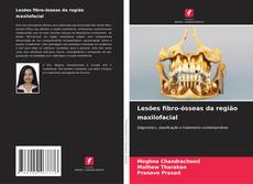 Couverture de Lesões fibro-ósseas da região maxilofacial