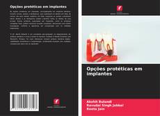 Bookcover of Opções protéticas em implantes
