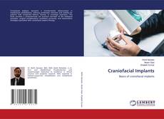 Bookcover of Craniofacial Implants