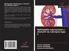 Buchcover von Nefropatia cukrzycowa u chorych na cukrzycę typu 1