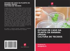 Copertina di ESTUDO DE CASO DA PLANTA DA BANANA (MUSA) CULTURA DE TECIDOS