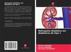 Bookcover of Nefropatia diabética em diabéticos de tipo 1