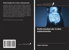 Buchcover von Enfermedad de Crohn estenosante